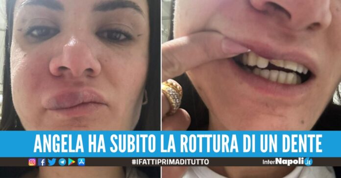 Pugno in faccia e 'strascino' all'infermiera, follia all'ospedale di Castellammare