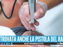 Spara e colpisce il tatuatore a Pomigliano, arrestato un 25enne pregiudicato