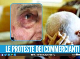 Anziano pestato ad Afragola, i commercianti: "Siamo ostaggio delle baby-gang"
