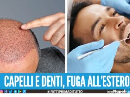Denti in Albania e Croazia, capelli in Turchia dalla Campania boom di richieste per il turismo medico