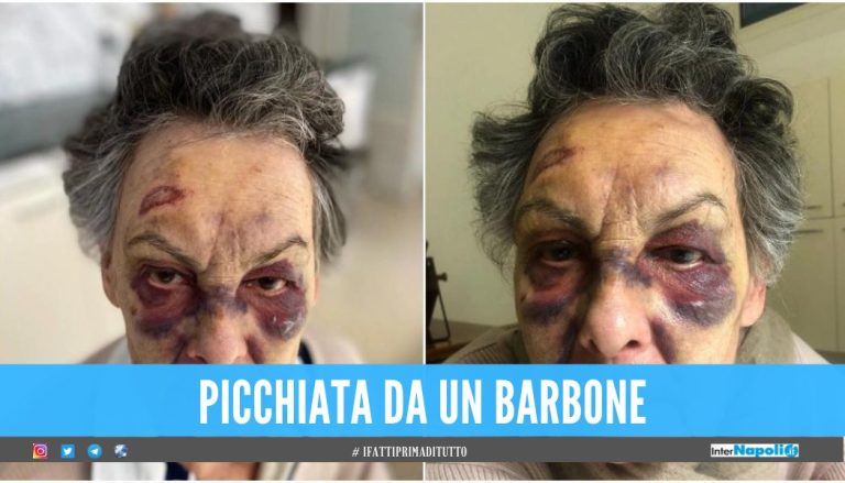 Donna anziana viene bastonata da un senzatetto a Milano, in zona Sant'Ambrogio.