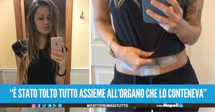 Deborah De Luca operata per un tumore, la dj di Scampia La prevezione è importante