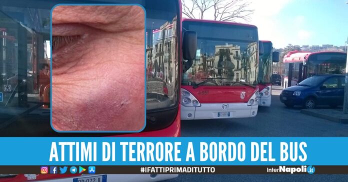autista aggredito bus napoli-afragola