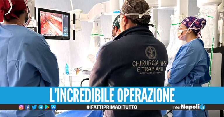 Doppio trapianto di rene incrociato da donatore vivente, lo straordinario intervento a Napoli