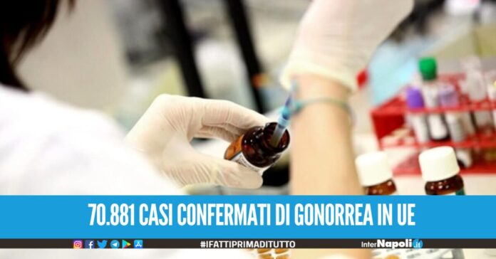 70.881 casi confermati di gonorrea in UE