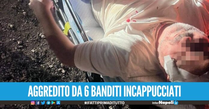 Quarto. Rientra a casa dopo il lavoro ma viene rapinato, picchiato ed accoltellato