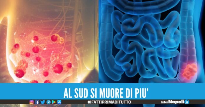 I casi di tumori sono più letali al sud.