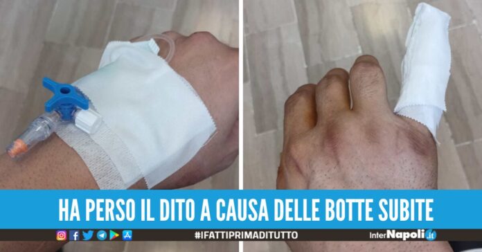 marechiaro si oppone al parcheggiatore abusivo