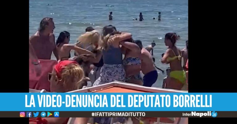 Rissa sul nodo lido a Varcaturo, lite scoppiata per un lettino