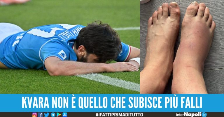 kvaratskhelia kvara piedi falli subiti