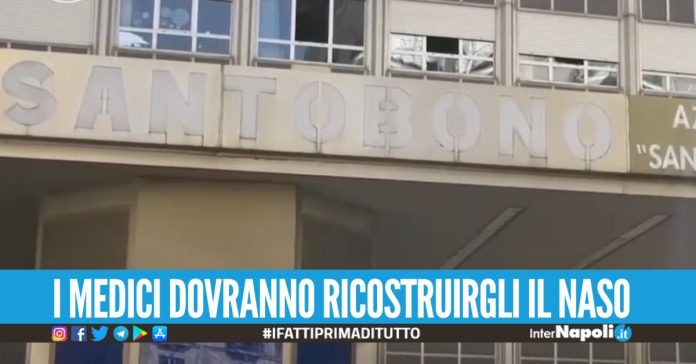 Bimbo di 6 anni azzannato da un cane, finisce al Santobono