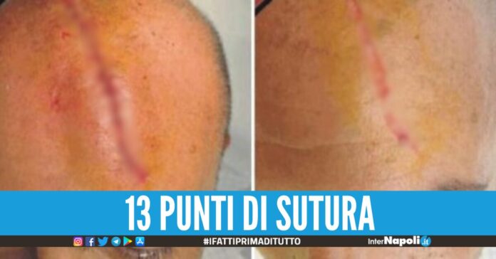 Sangiuliano ferito alla testa dopo la lita con Boccia Report mostra le foto in esclusiva