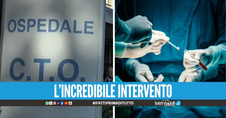 Fratture di femore, al CTO di Napoli l'operazione hi-tech che riduce le infezioni post intervento