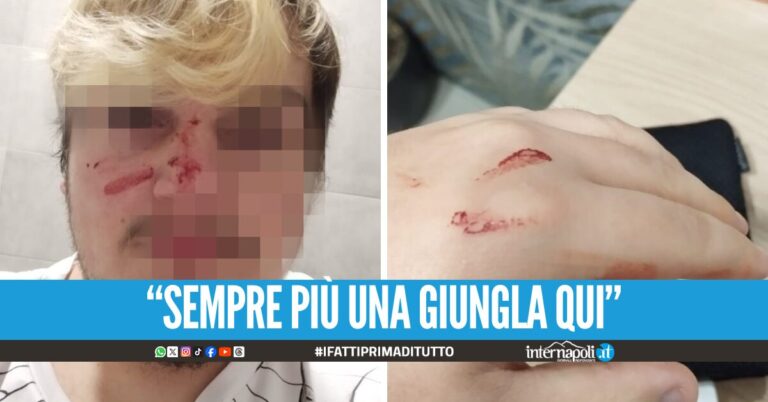 Lite choc a Bacoli, picchiato in strada per aver suonato il clacson