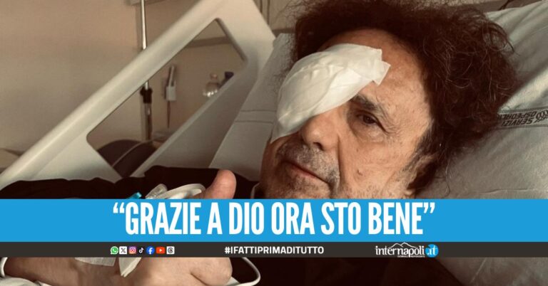 Enzo Avitabile operato a Bologna, trapianto di cornea per il musicista