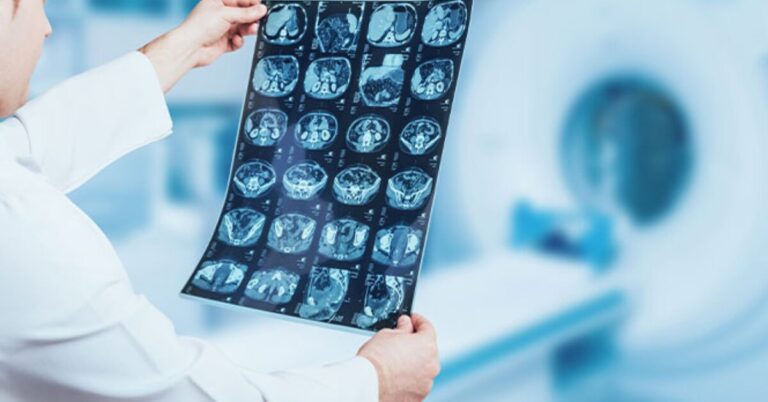 tecnico radiologia medica online eisaf
