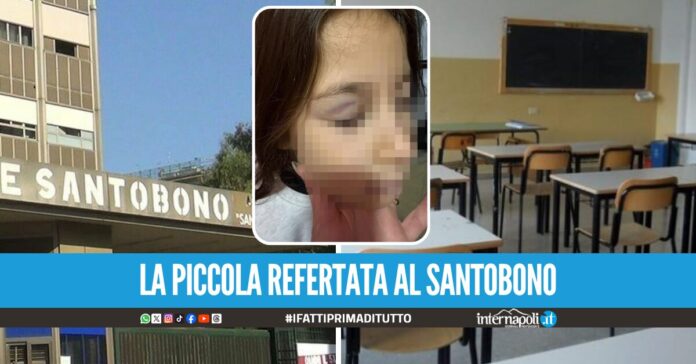 Mia figlia di 8 anni aggredita a scuola dai bulli, la denuncia di una mamma a Napoli
