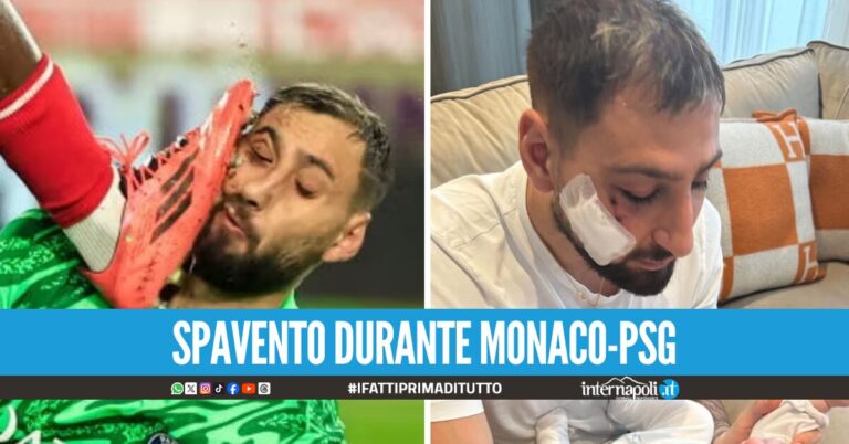 "Trauma facciale con ferite multiple", infortunio choc per Donnarumma