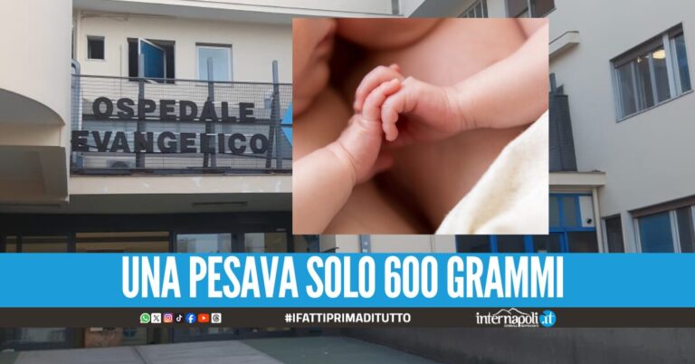 Gemelle nate premature nel Napoletano, non sono più in pericolo di vita