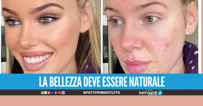 Instagram cambia tutto, addio ai filtri bellezza Decisione per tutelare i giovani