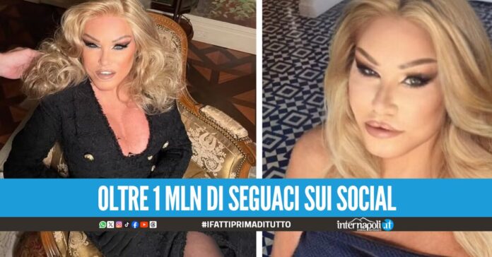 Morta la donna gatto, aveva speso oltre 2 milioni di euro in chirurgia estetica