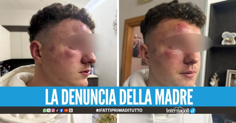 Movida violenta ad Aversa, 14enne preso a pugni e calci da due ventenni