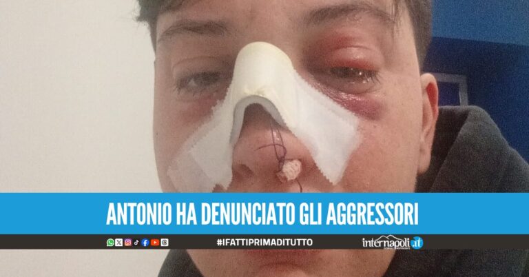 Difese una donna a Napoli, trans picchiato e mandato in ospedale: la denuncia
