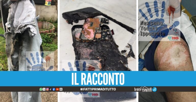 Gli esplode il cellulare in tasca mentre è alla guida, gamba ustionata e jeans distrutti