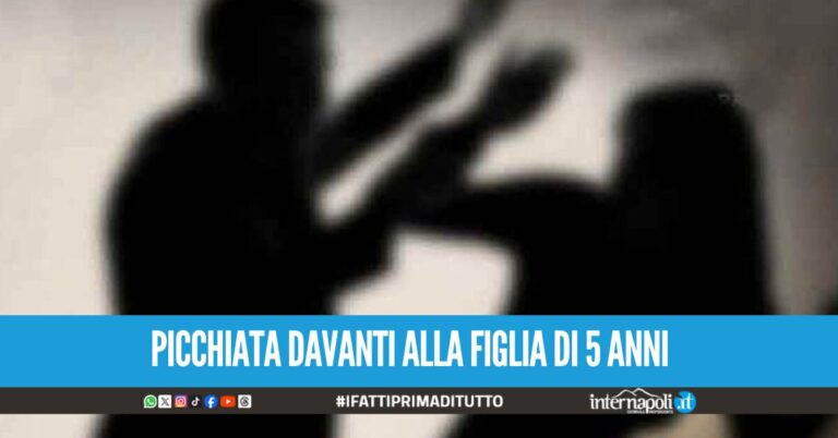 Orrore a Giugliano, litiga con la compagna e le spacca due denti e la mandibola