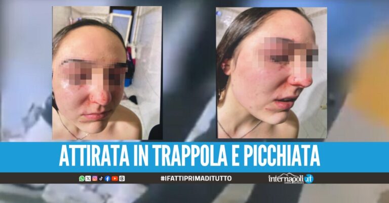 Ragazzina aggredita a Marano, identificata la responsabile ha solo 12 anni