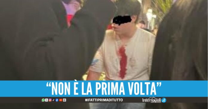 Ragazzini accoltellano un coetaneo in piazza a Portici la denuncia dei residenti