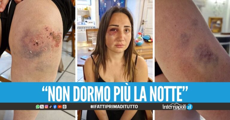 "Sono una sopravvissuta, ora vivo con la paura di morire", il racconto di Gaia picchiata dall'ex a Pozzuoli