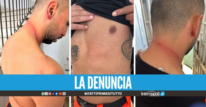 San Giovanni a Teduccio, paziente in codice rosso aggredisce i medici del 118