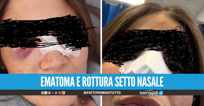 Mia figlia colpita da una bottiglia di vetro fuori al Maradona: la denuncia
