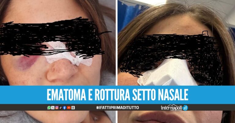 Mia figlia colpita da una bottiglia di vetro fuori al Maradona: la denuncia