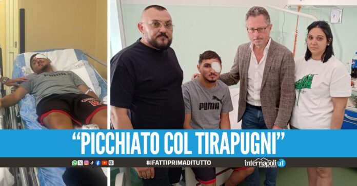 Ciro massacrato di botte a Portici, i familiari denunciano: 