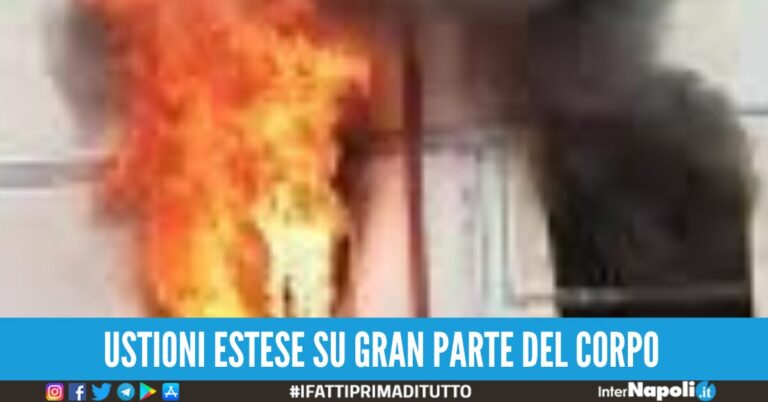 Gravemente ferito dopo un’esplosione in casa, uomo ricoverato al Cardarelli