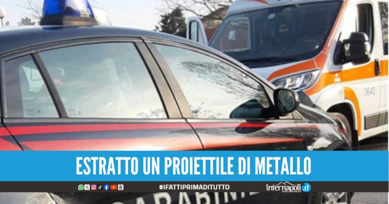 Colpita da un pallino di carabina, in ospedale 11enne del Napoletano