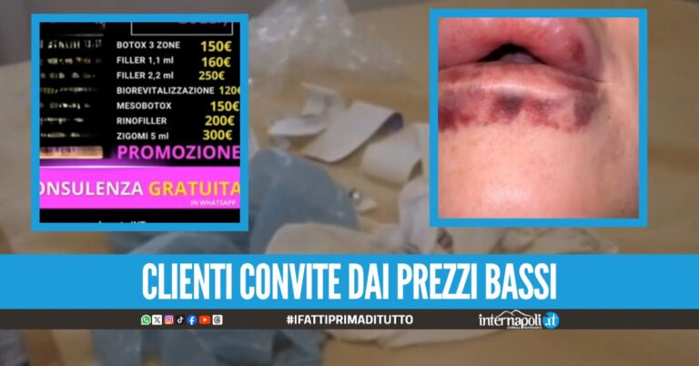 Botulino e filler con farmaci pericolosi, beccata la falsa dottoressa