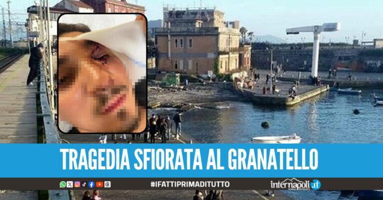Giovane massacrato di pugni a Portici, "punito" per aver salutato una ragazza