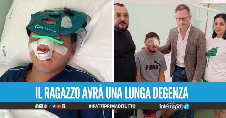 Ciro aggredito a pugni a Portici, il ragazzo è stato operato al Cardarelli