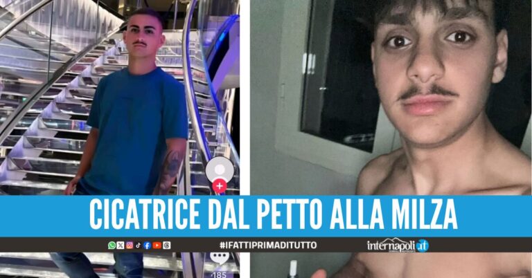 Salvatore Sannino vittima di una rapina con accoltellamento 9 mesi fa, l'ipotesi della vendetta contro Nicola Mirti