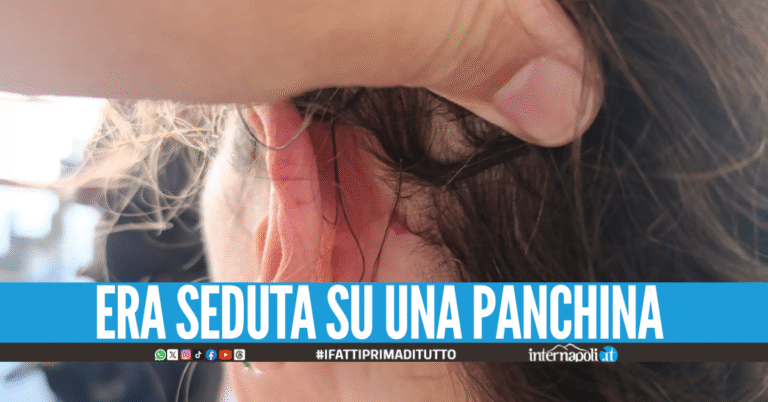 Napoli, donna centrata alla testa da un colpo di pistola