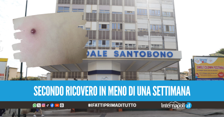 Nuovo ricovero per il bimbo morso dal ragno violino a Caivano, il piccolo ha febbre molto alta
