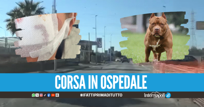 Attimi di paura a Villaricca 2, donna aggredita in strada dal pitbull