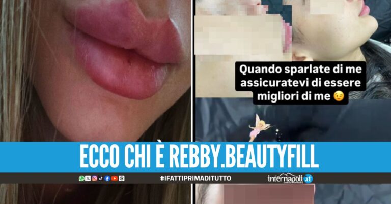 "Dove sognare si può", denunciata l'estetista-tiktoker di Villaricca