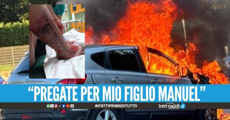 Dramma nel Napoletano, bimbo di 10 anni avvolto dalle fiamme di un'auto