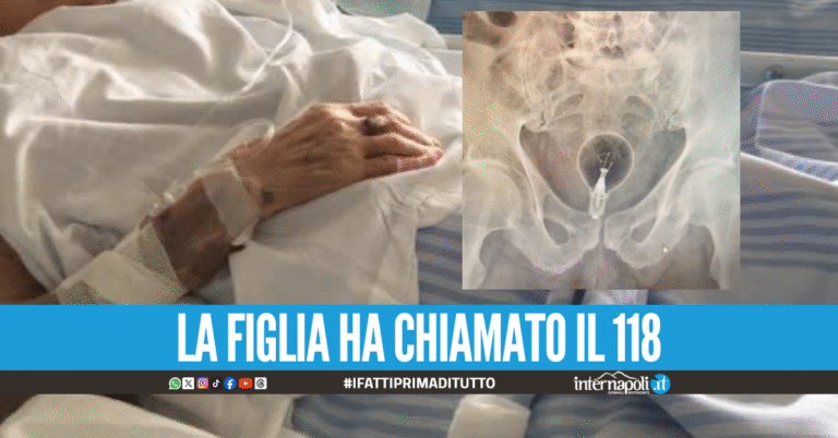Ho una lampadina nel retto, 85enne operato d'urgenza a Lecce