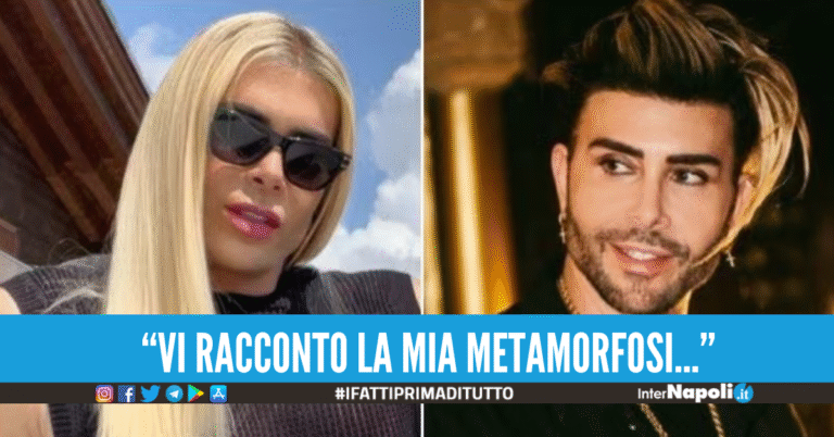 Da Giacomo a Jenny, com’è cambiata Urtis grazie al bisturi