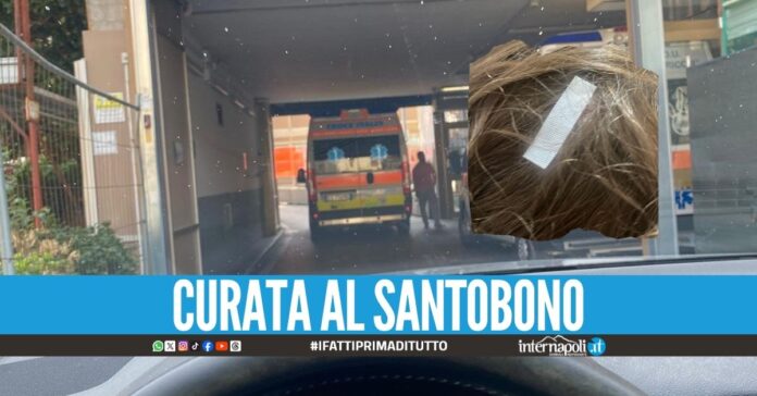 Bimba cade in casa ad Ercolano, i carabinieri